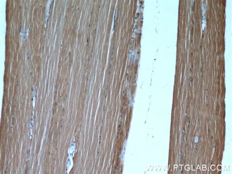 PAMR1 antibody (55310-1-AP) | Proteintech
