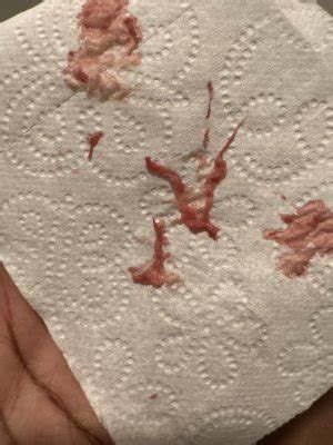 Is this implantation bleeding? | BabyCenter