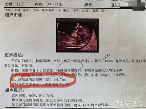 孕11~13周的孕妈咪，早期排畸检查是时候要安排了！ | 新闻资讯 | 广州爱博恩妇产医院,广州爱博恩官方网站,广州高端妇产医院,爱博恩医学月子服务