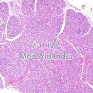 Salivary Gland Lesions Digital Slides Manufacturer, Supplier from Noida