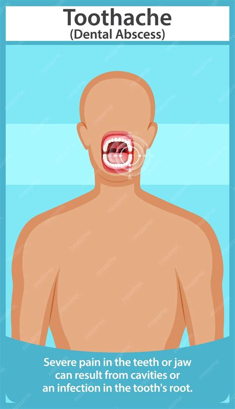 Toothache 的图像结果