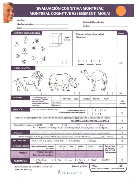 Protocolo Montreal Cognitive Assessment Moca | PDF