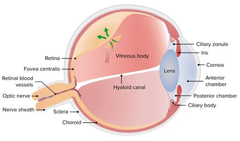 Retinal Detachment | Concise Medical Knowledge