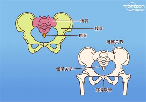 盆骨问题可以使用盆底肌修复仪器治疗0广州通泽医疗科技有限公司