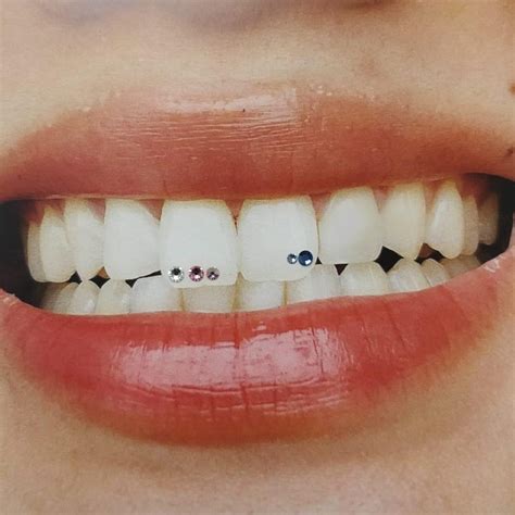 Image result for DIY Tooth Gems