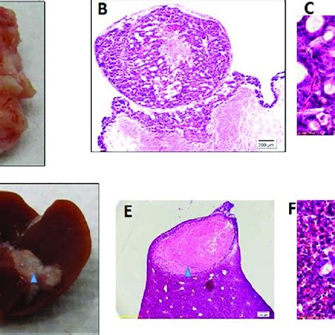 Image result for Intraperitoneal Injection Mice Model