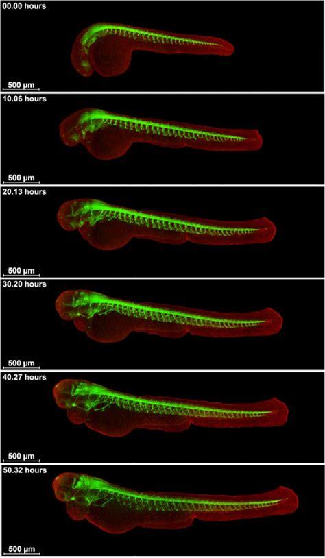 Zebrafish Embryo Time-Lapse 的图像结果