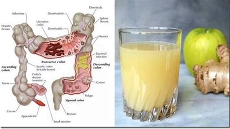 Jugo para limpiar el colon.. - Remedios consejos y SaludRemedios consejos y Salud