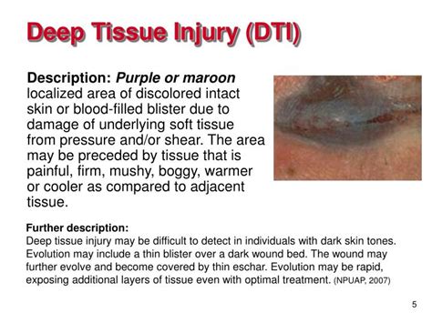 Image result for Deep Tissue Injuries