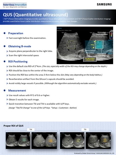 Image result for Qabs Tutorial