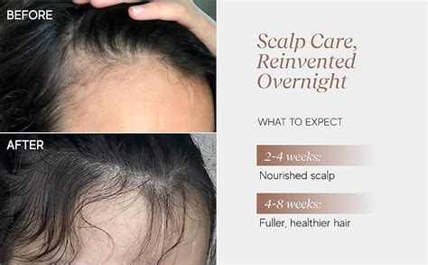 indē wild Moonlight Overnight Scalp Serum/Hair Growth Serum 50ml ...