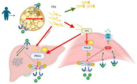 Converging Pathways between Metabolic Dysfunction–Associated Steatotic ...