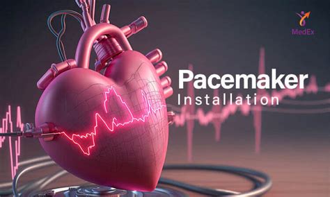 Image result for Installing Pacemaker