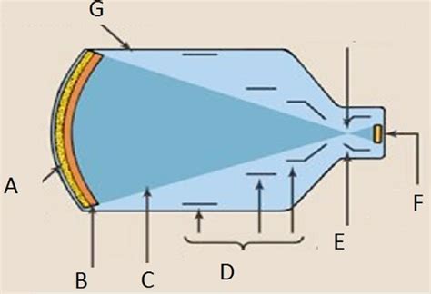 Image result for Conventional Fluoroscopy