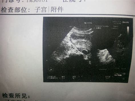 怀孕四周，彩超检查宫腔内偏右侧宫角可见7*7囊样无回声 - 百度宝宝知道