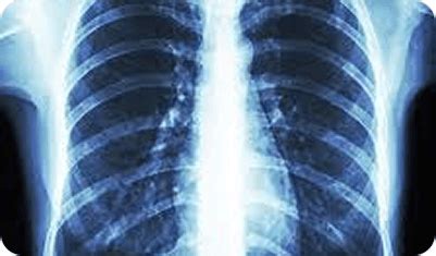 Advanced MRI, CT, Ultrasound & X-Ray Scans | Uniscans & Labs Chennai