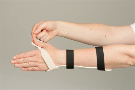 Extensor Tendon Repair (thumb), a guide to your therapy - Leeds ...