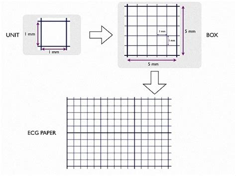 ECG Paper Measurements Diagram | Quizlet