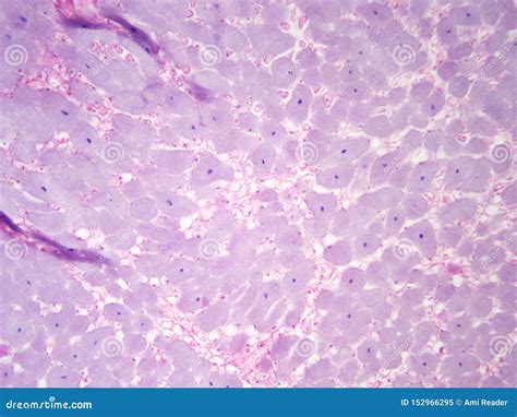 Bacterial Cell Under Microscope 100x