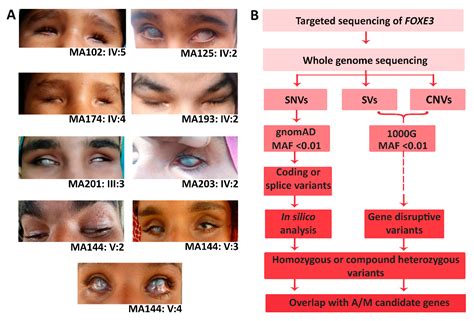 Combined Single Gene Testing and Genome Sequencing as an Effective ...