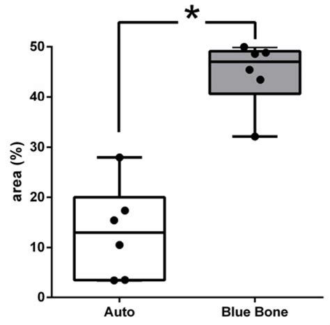Comparison Between Nano-Hydroxyapatite/Beta-Tricalcium Phosphate ...