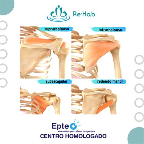 Manguito Rotador. Conjunto de cuatro músculos responsables de la rotación de hombro, los cuales ...