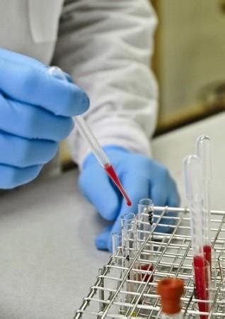 New Blood Test Diagnoses Sepsis in 2 Hours - IBTimes India