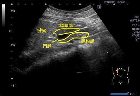 Image result for Quick Start Algorithm Contraception