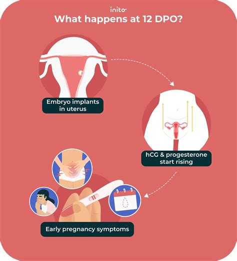 12 DPO Symptoms: What to Expect
