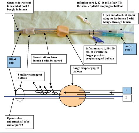 Esophageal Tracheal Tube Vs Endotracheal Tube