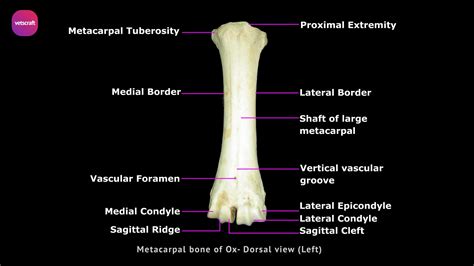 Metacarpal Bone Anatomy