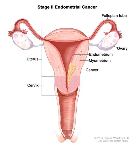 Image result for Endometrium Cell