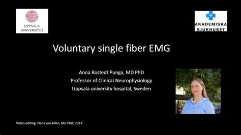 Image result for Single Fiber EMG Test