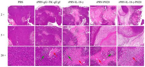 A Recombinant Oncolytic Pseudorabies Virus Expressing Interleukin-18 ...