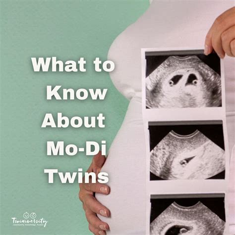 What to Know About Monochorionic Diamniotic Twins | Twiniversity #1 ...