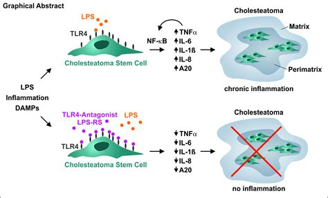 Stem Cell-Induced Inflammation in Cholesteatoma Is Inhibited by the ...