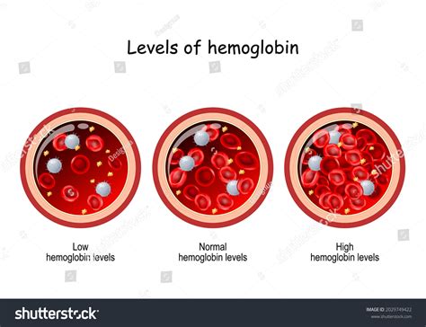 What Happens When Hemoglobin Is High