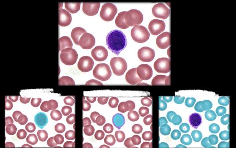 Image result for Chapter 4 Blood Sign