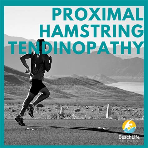 Proximal Hamstring Tendinopathy