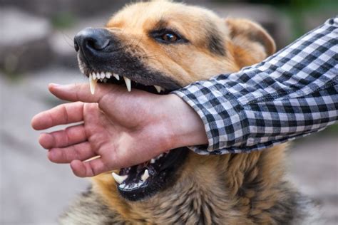 treatment to dog bite