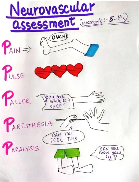 Neurovascular Assessment - The 5 P’s Mnemonic for Limb Evaluation