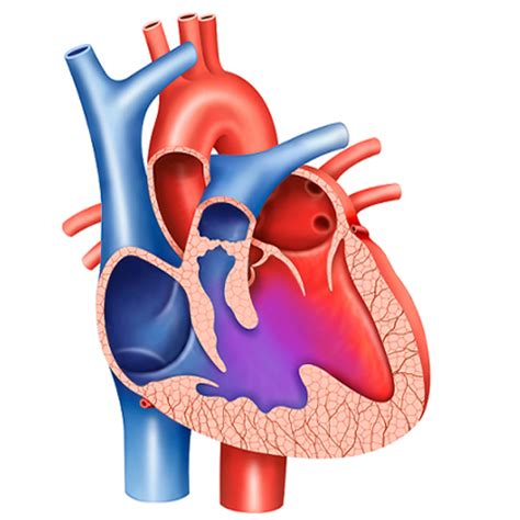 Ventricular septal defect (VSD) - Symptoms and causes | Medtalks