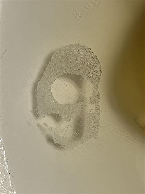 Are bubbles in the urine normal? : r/AskDocs