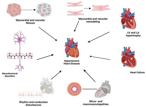 Hypertensive Heart Disease: A Narrative Review Series—Part 1: Pathophysiology and ...