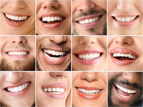 Unlock Your Perfect Smile: A Complete Guide to Invisalign Aligners in ...