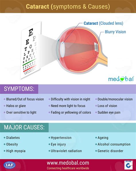 Cataracts Symptoms Red Eyes at Tia Curtis blog