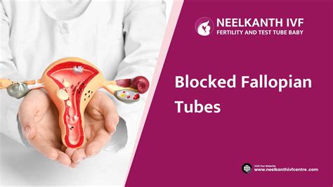 Blocked Fallopian Tubes: The Pros And Cons Of Surgery – NQETJ
