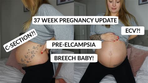 Pregnancy week 37 | Pregnancy changes week by week - Kidborn