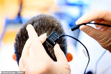 Breakthrough device reads brainwaves and turns thoughts into speech