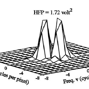 Image result for Contralateral Hemisphere